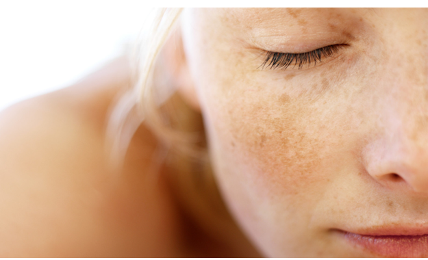 Glutathione BC White – Siêu phẩm trị nám soán ngôi “soái ca” trong lòng chị em Glutathione BC White – Siêu phẩm trị nám soán ngôi “soái ca” trong lòng chị em